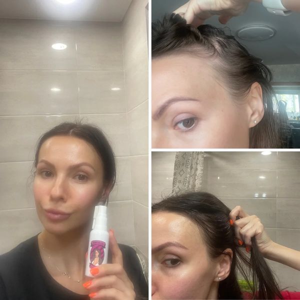 Лосьйон для росту волосся Minox 2% 50 мл Minox 2% 200 мл фото