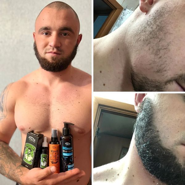 Лосьон для ухода и уплотнения бороды Minox 7% 50 мл Minox 7% 50 мл фото